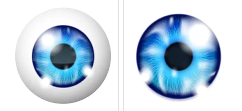 ما بعد عملية الليزك