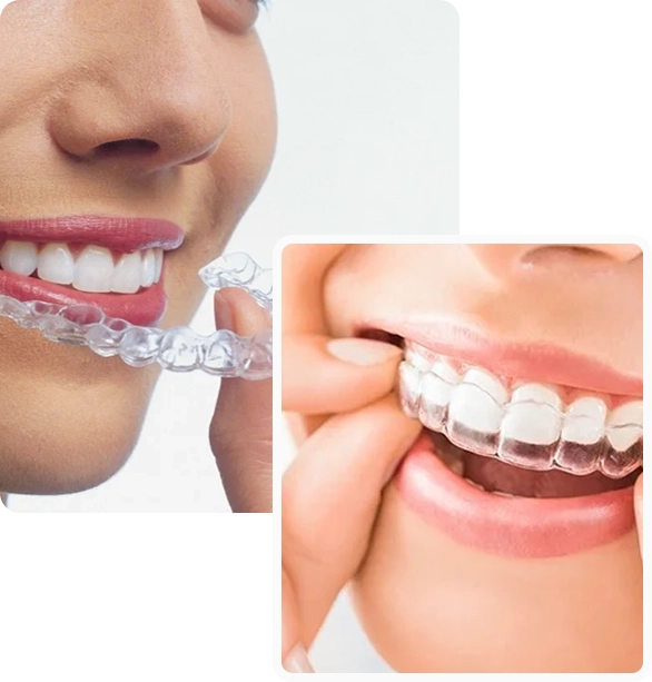 شفاف التقويم