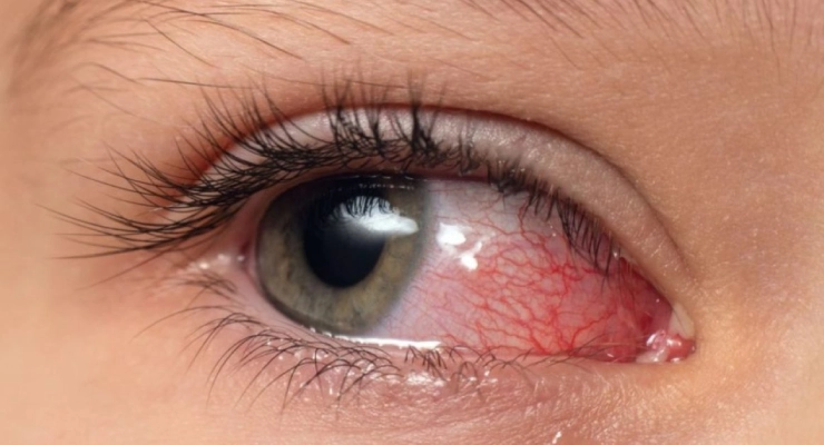 Ophthalmic Technologies