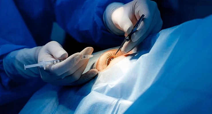 افضل دكتور زراعة قرنية في جدة