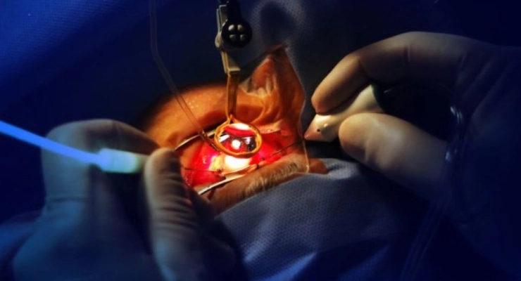 معايير اختيار أفضل دكتور جراحة شبكية في جدة