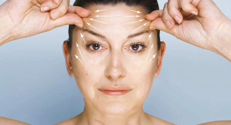 النتائج المتوقعة بعد رفع الحاجب الصدغي