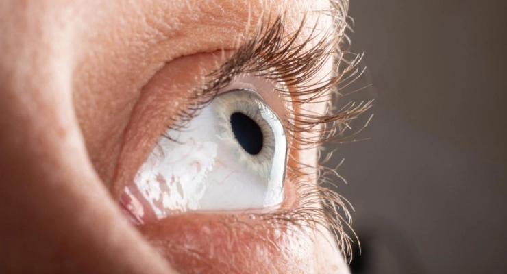 طرق علاج التهاب القزحية