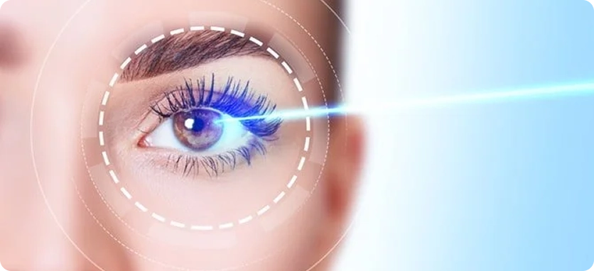 PRELEX تبادل عدسة الانكسار