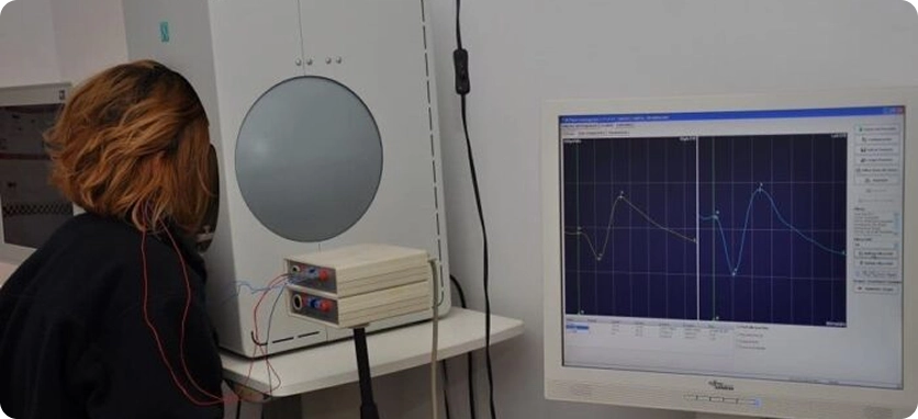 تخطيط كهربائية العين (EOG)