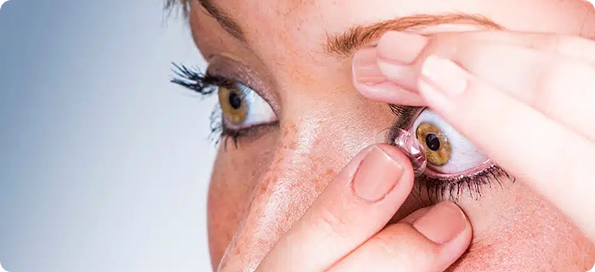 مشكلة تهيج العين بعد استخدام عدسات لاصقة