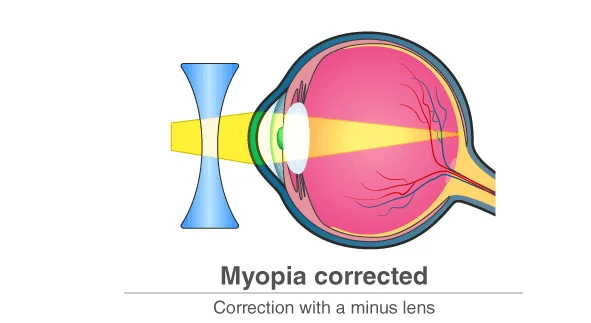 Prescription Eyeglasses