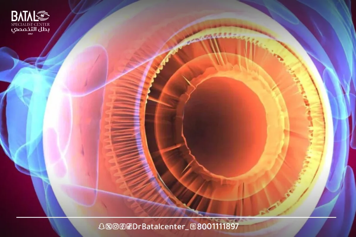 Are There Cases Where Vision Does Not Return to 6/6 After LASIK?