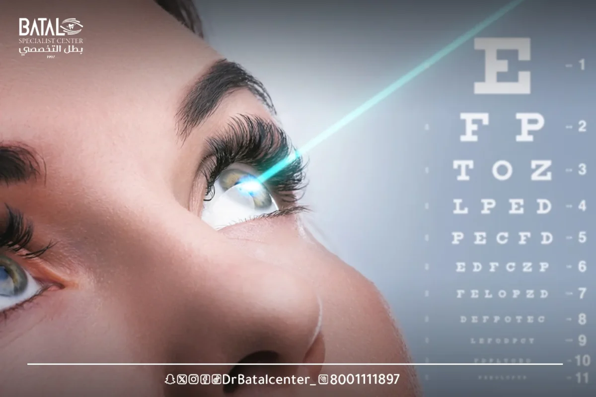 Will Vision Return to 6/6 After LASIK Surgery?