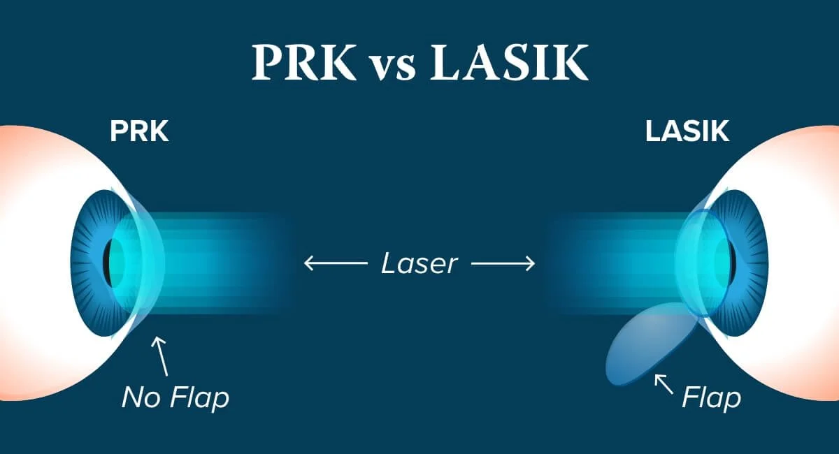 How Is PRK Different from LASIK?
