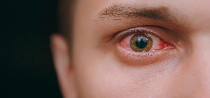 ألم العين المفاجئ في عين واحدة