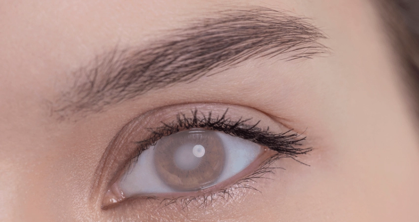 أفضل دكتور مياه بيضاء في ينبع