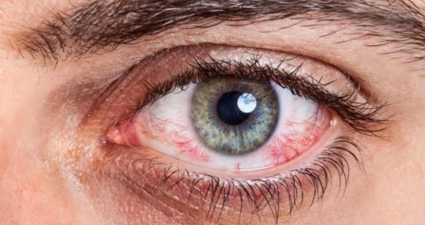 علاج العيون ينبع