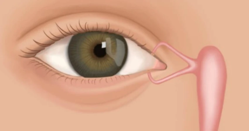 أفضل دكتور لعلاج مشاكل القناة الدمعية في ينبع